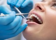 Painless Wisdom Teeth Extraction: What to Expect and How to Prepare