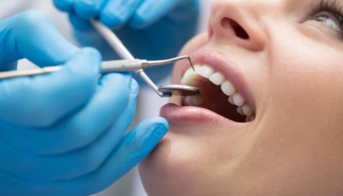 Painless Wisdom Teeth Extraction: What to Expect and How to Prepare