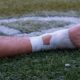 Sport Safety: 4 Common Sports Injuries and How to Treat Them (2023)