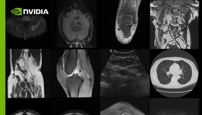 MONAI medical imaging AI cloud service introduced by NVIDIA